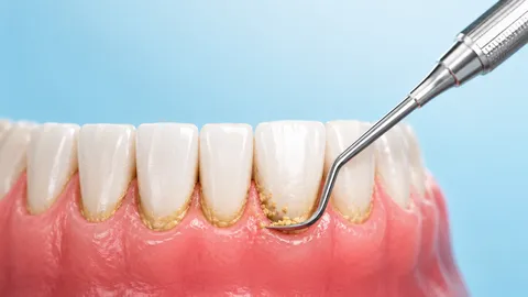 Periodontia